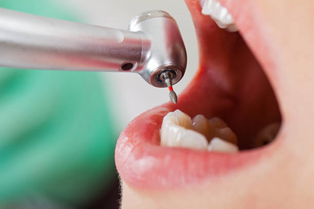 Best Emergency Dental Care for Sports Injuries in Sam Rayburn, TX